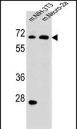 Invitrogen ME2 Polyclonal Antibody 400 &mu;L; Unconjugated:Antibodies,