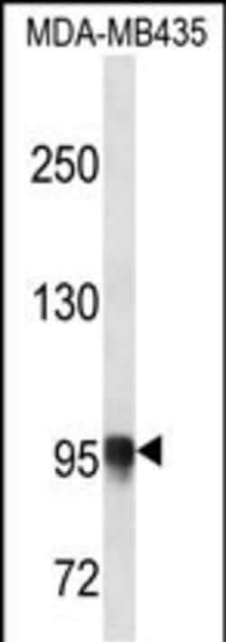 Invitrogen PLOD3 Polyclonal Antibody 400 &mu;L; Unconjugated:Antibodies,