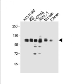 Invitrogen XYLT1 Polyclonal Antibody 400 &mu;L; Unconjugated:Antibodies,