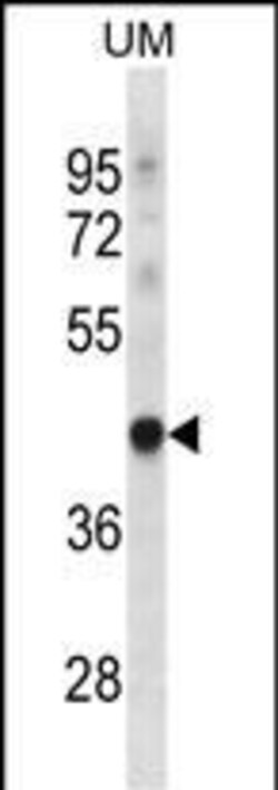 Invitrogen TRUB1 Polyclonal Antibody 400 &mu;L; Unconjugated:Antibodies,