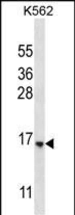 Invitrogen STARD5 Polyclonal Antibody 400 &mu;L; Unconjugated:Antibodies,