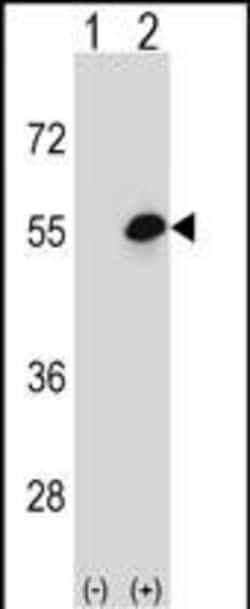 Invitrogen COCH Polyclonal Antibody 400 &mu;L; Unconjugated:Antibodies,