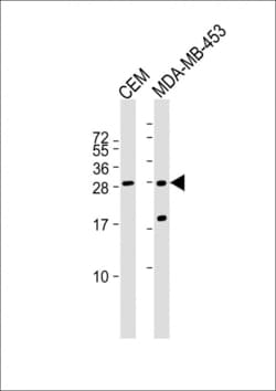 Invitrogen IFI6 Polyclonal Antibody 400 &mu;L | Buy Online | Invitrogen&trade; | Fisher Scientific