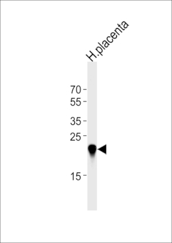 Invitrogen CSHL1 Polyclonal Antibody 400 &mu;L; Unconjugated:Antibodies,
