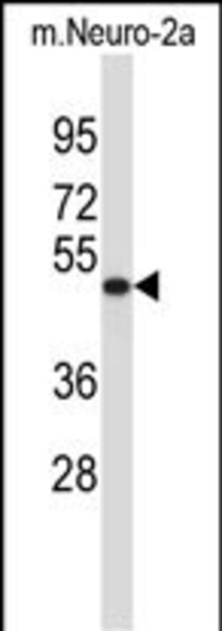 Invitrogen VAT1L Polyclonal Antibody 400 &mu;L; Unconjugated:Antibodies