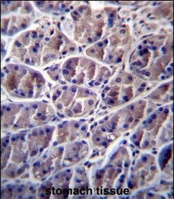 Invitrogen Calpain 8 Polyclonal Antibody 400 &mu;L; Unconjugated:Antibodies,