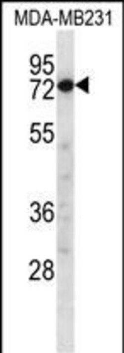 Invitrogen Calpain 8 Polyclonal Antibody 400 &mu;L; Unconjugated:Antibodies,
