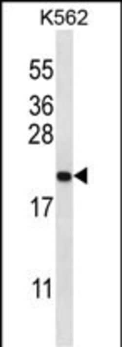 Invitrogen GAGE2B Polyclonal Antibody 400 &mu;L; Unconjugated:Antibodies,