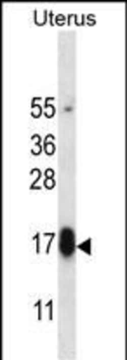 Invitrogen GPHB5 Polyclonal Antibody 400 &mu;L; Unconjugated:Antibodies,