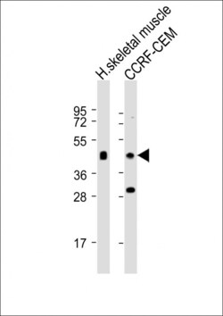 Invitrogen SLC16A10 Polyclonal Antibody 400 &mu;L; Unconjugated:Antibodies,