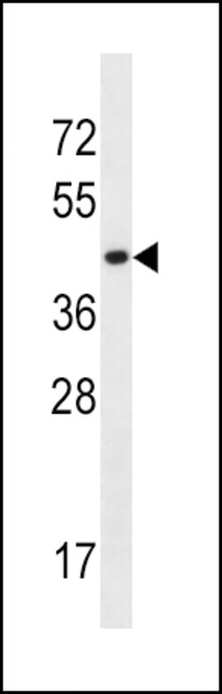 Invitrogen SLC16A10 Polyclonal Antibody 400 &mu;L; Unconjugated:Antibodies,