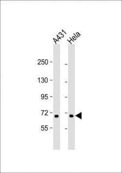 Invitrogen CCDC120 Polyclonal Antibody 400 &mu;L; Unconjugated:Antibodies,
