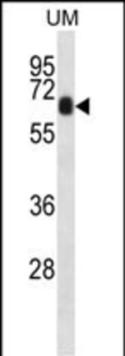 Invitrogen CCDC120 Polyclonal Antibody 400 &mu;L; Unconjugated:Antibodies,
