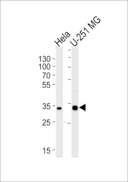 Invitrogen TAF8 Polyclonal Antibody 400 &mu;L; Unconjugated:Antibodies,
