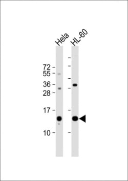 Invitrogen PHF5A Polyclonal Antibody 400 &mu;L; Unconjugated:Antibodies,