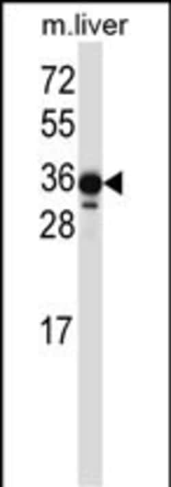 Invitrogen LIMS2 Polyclonal Antibody 400 &mu;L | Buy Online | Invitrogen&trade; | Fisher Scientific
