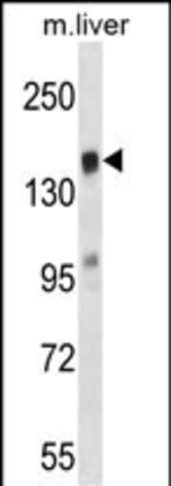 Invitrogen TIAM2 Polyclonal Antibody 400 &mu;L; Unconjugated:Antibodies,