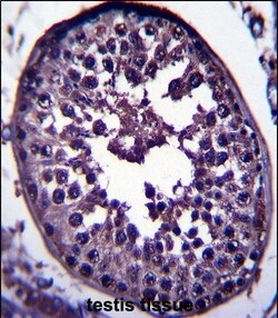 Invitrogen GAGE12H Polyclonal Antibody 400 &mu;L; Unconjugated:Antibodies,