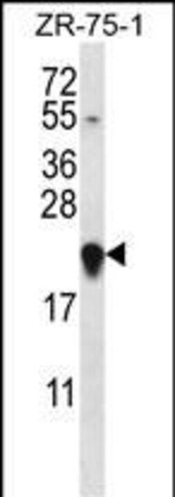 Invitrogen GAGE12H Polyclonal Antibody 400 &mu;L; Unconjugated:Antibodies,