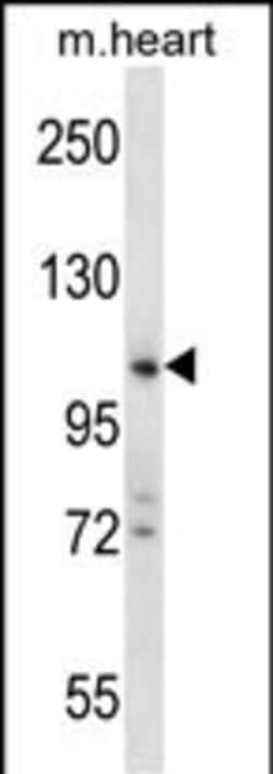 Invitrogen ZCCHC14 Polyclonal Antibody 400 &mu;L; Unconjugated:Antibodies,