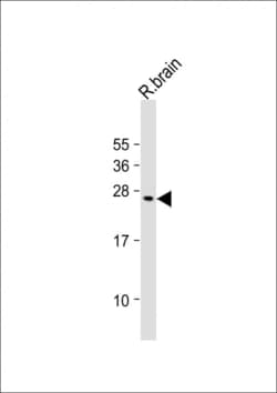 Invitrogen VKORC1L1 Polyclonal Antibody 400 &mu;L; Unconjugated:Antibodies,