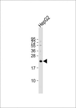 Invitrogen VKORC1L1 Polyclonal Antibody 400 &mu;L; Unconjugated:Antibodies,