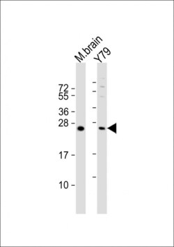 Invitrogen VKORC1L1 Polyclonal Antibody 400 &mu;L; Unconjugated:Antibodies,