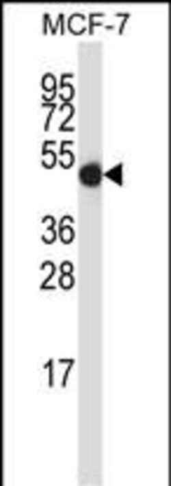 Invitrogen GDI2 Polyclonal Antibody 400 &mu;L | Buy Online | Invitrogen&trade; | Fisher Scientific