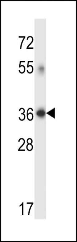 Invitrogen DHRS7C Polyclonal Antibody 400 &mu;L; Unconjugated:Antibodies,