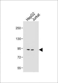 Invitrogen MGAT5 Polyclonal Antibody 400 &mu;L; Unconjugated:Antibodies,