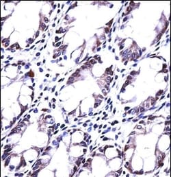 Invitrogen HRASLS5 Polyclonal Antibody 400 &mu;L; Unconjugated:Antibodies,