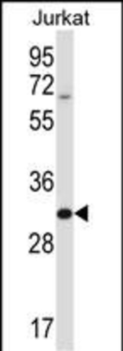 Invitrogen HRASLS5 Polyclonal Antibody 400 &mu;L; Unconjugated:Antibodies,