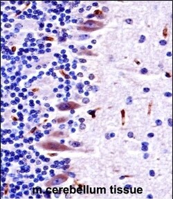 Invitrogen MLK4 Polyclonal Antibody 400 &mu;L; Unconjugated:Antibodies,