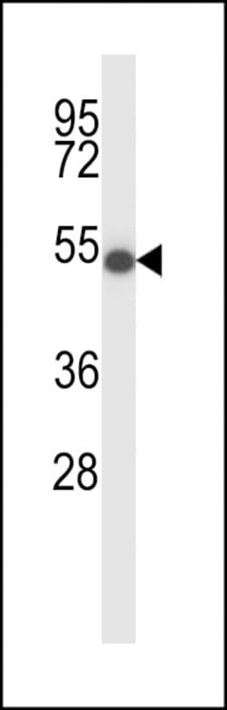 Invitrogen ZDHHC16 Polyclonal Antibody 400 &mu;L; Unconjugated:Antibodies,