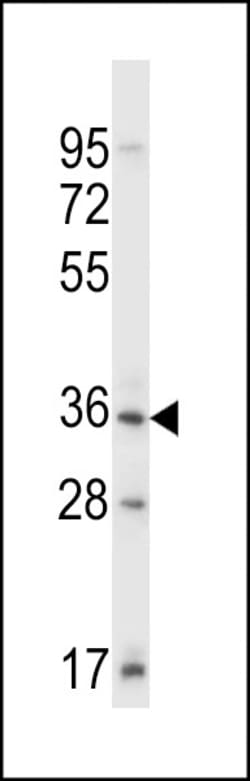 Invitrogen Sgk110 Polyclonal Antibody 400 &mu;L; Unconjugated:Antibodies,