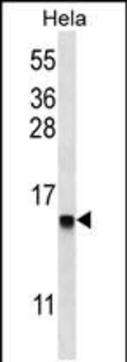 Invitrogen DEFB112 Polyclonal Antibody 400 &mu;L; Unconjugated:Antibodies,