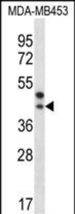 Invitrogen PPT2 Polyclonal Antibody 400 &mu;L; Unconjugated:Antibodies,