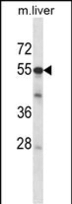 Invitrogen ADCK2 Polyclonal Antibody 400 &mu;L; Unconjugated:Antibodies,