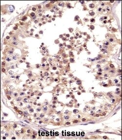 Invitrogen TSPY1 Polyclonal Antibody 400 &mu;L; Unconjugated:Antibodies,