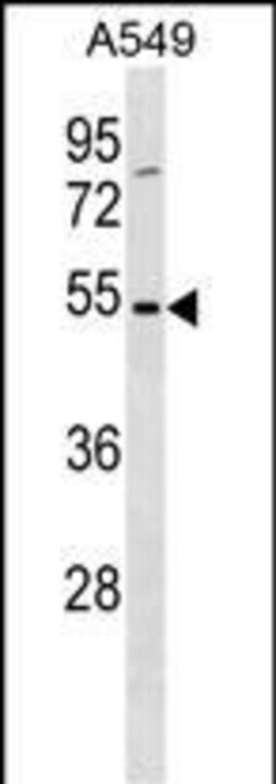 Invitrogen TM6SF1 Polyclonal Antibody 400 &mu;L; Unconjugated:Antibodies,