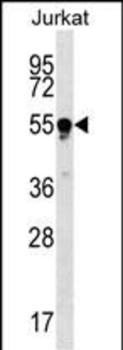 Invitrogen TUBB4Q Polyclonal Antibody 400 &mu;L; Unconjugated:Antibodies,