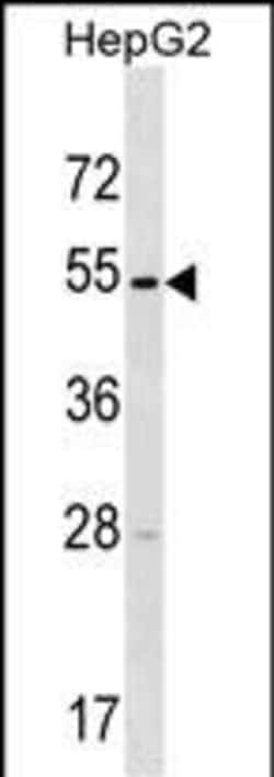 Invitrogen TMPRSS11E Polyclonal Antibody 400 &mu;L; Unconjugated:Antibodies,