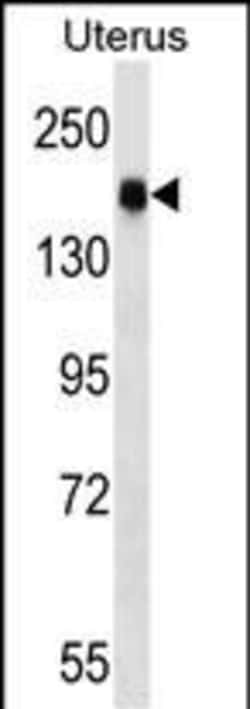 Invitrogen CGNL1 Polyclonal Antibody 400 &mu;L; Unconjugated:Antibodies,