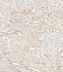 Invitrogen RAB28 Polyclonal Antibody 400 &mu;L; Unconjugated:Antibodies,