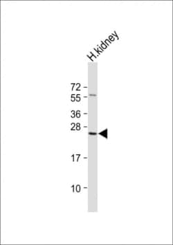 Invitrogen RAB28 Polyclonal Antibody 400 &mu;L; Unconjugated:Antibodies,