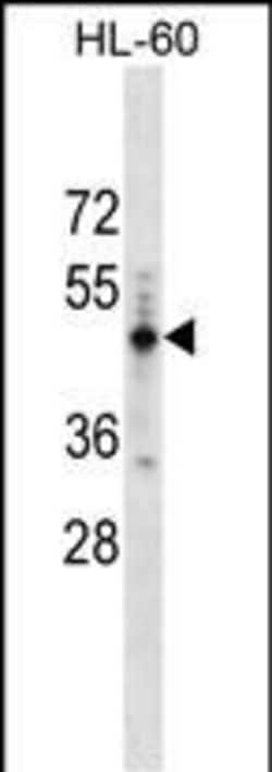 PRAMEF14 Polyclonal Antibody:Antibodies, Polyclonal