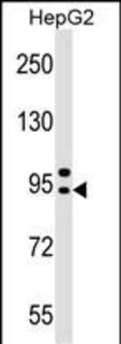 Invitrogen AP4B1 Polyclonal Antibody 400 &mu;L; Unconjugated:Antibodies,