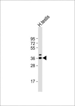 Invitrogen TSPY3 Polyclonal Antibody 400 &mu;L; Unconjugated:Antibodies,