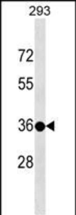 Invitrogen TSPY3 Polyclonal Antibody 400 &mu;L; Unconjugated:Antibodies,