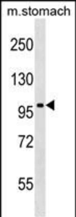 Invitrogen JIK Polyclonal Antibody 400 &mu;L; Unconjugated:Antibodies,